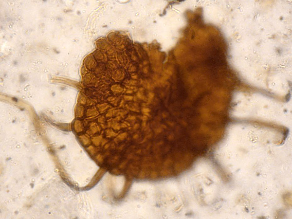 Seen under a microscope, it is a brown, multicellular, round structure with several thin extensions extending to the sides