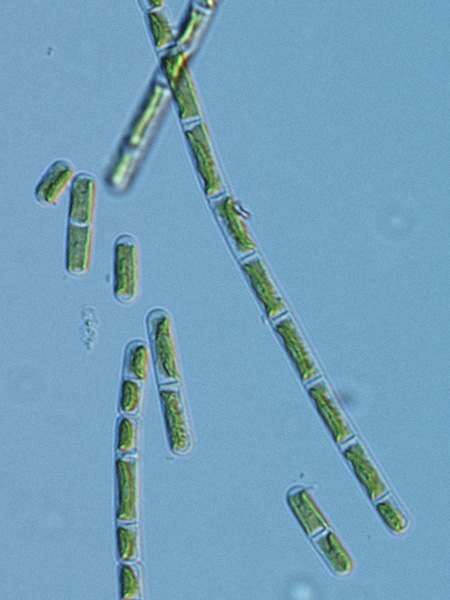 Filamentous green algae under a microscope. The filaments are composed of single cells joined in chains