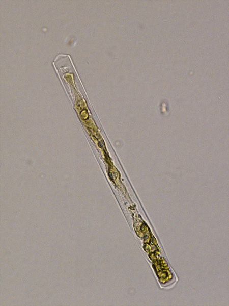 A transparent tubular cell seen under a microscope, filled with green amorphous contents