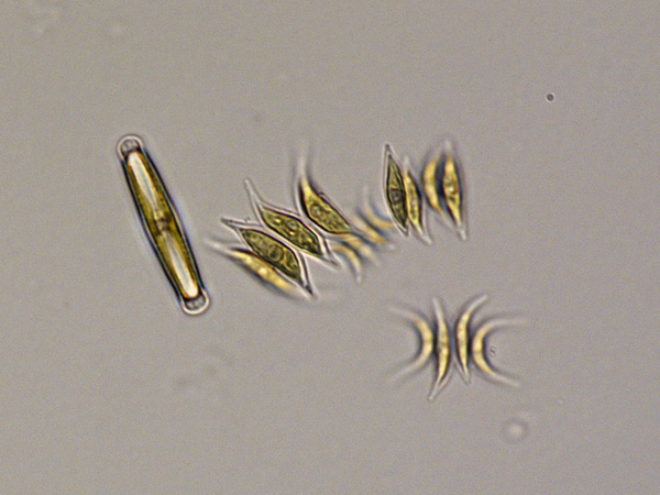 One cylindrical and several spindle-shaped transparent cells with green contents visible under a microscope