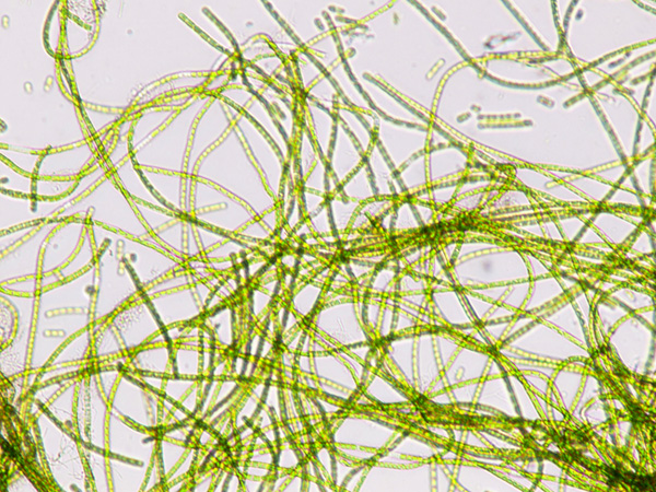 Dense tangle of green filamentous structures seen under a microscope. Each filament is composed of multiple cell segments
