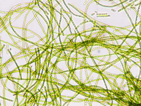 Seen under a microscope, a tangle of light green, thread-like structures formed by numerous cells connected in series