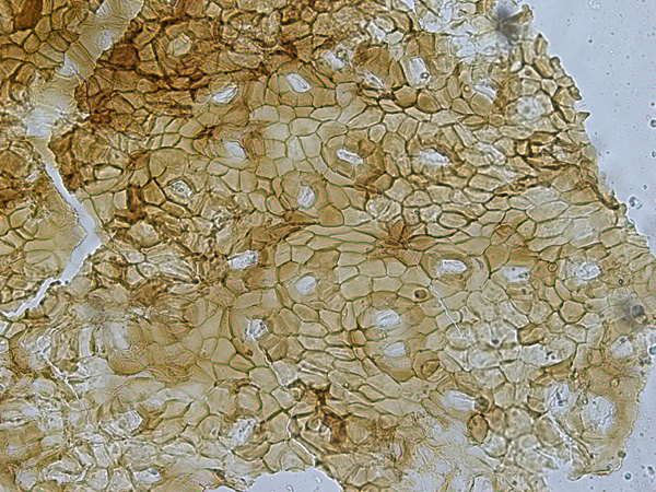 Seen under a microscope, a network of light brown cells with lighter spots of stomata